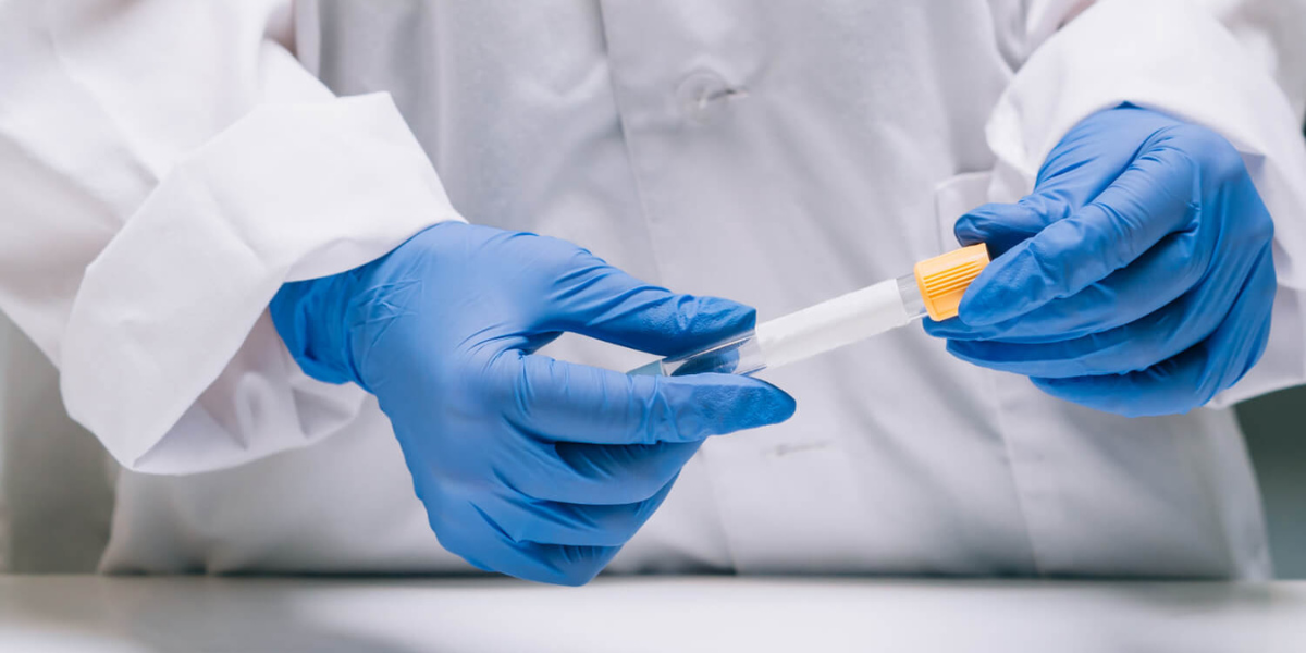 Langkah Penting Setelah Inseminasi Buatan untuk Pasangan